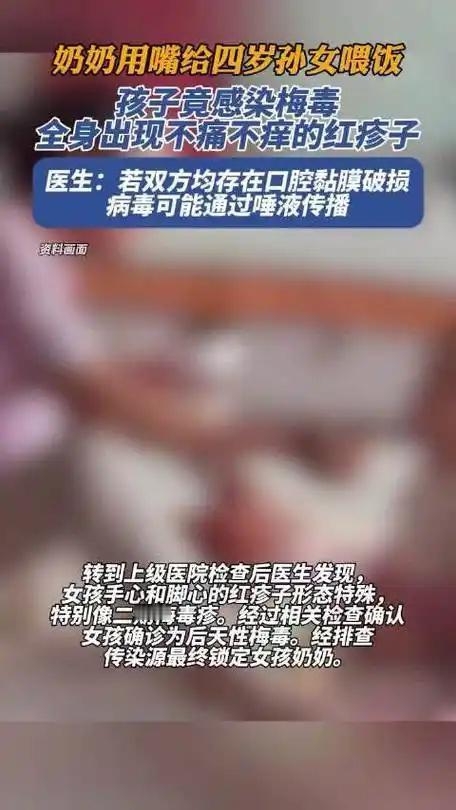 热议：奶奶用嘴给四岁孙女喂饭，孩子竟感染梅毒！除了性接触，这些途径更要防

奶奶