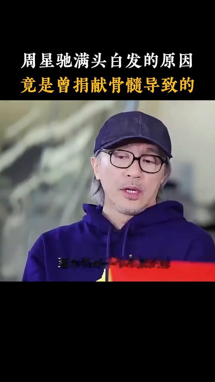 周星驰满头白发的原因竟是曾捐献骨髓导致的。
你知道周星驰那满头白发是怎么来的吗？