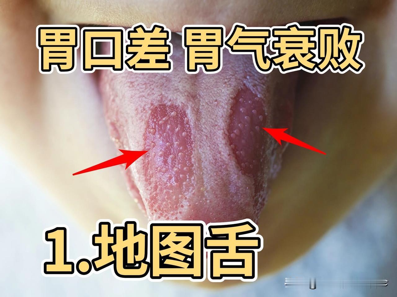 注意！！今日不忙，给公益看舌象——挑战年前看666个舌象，你发我看，结果马上出！