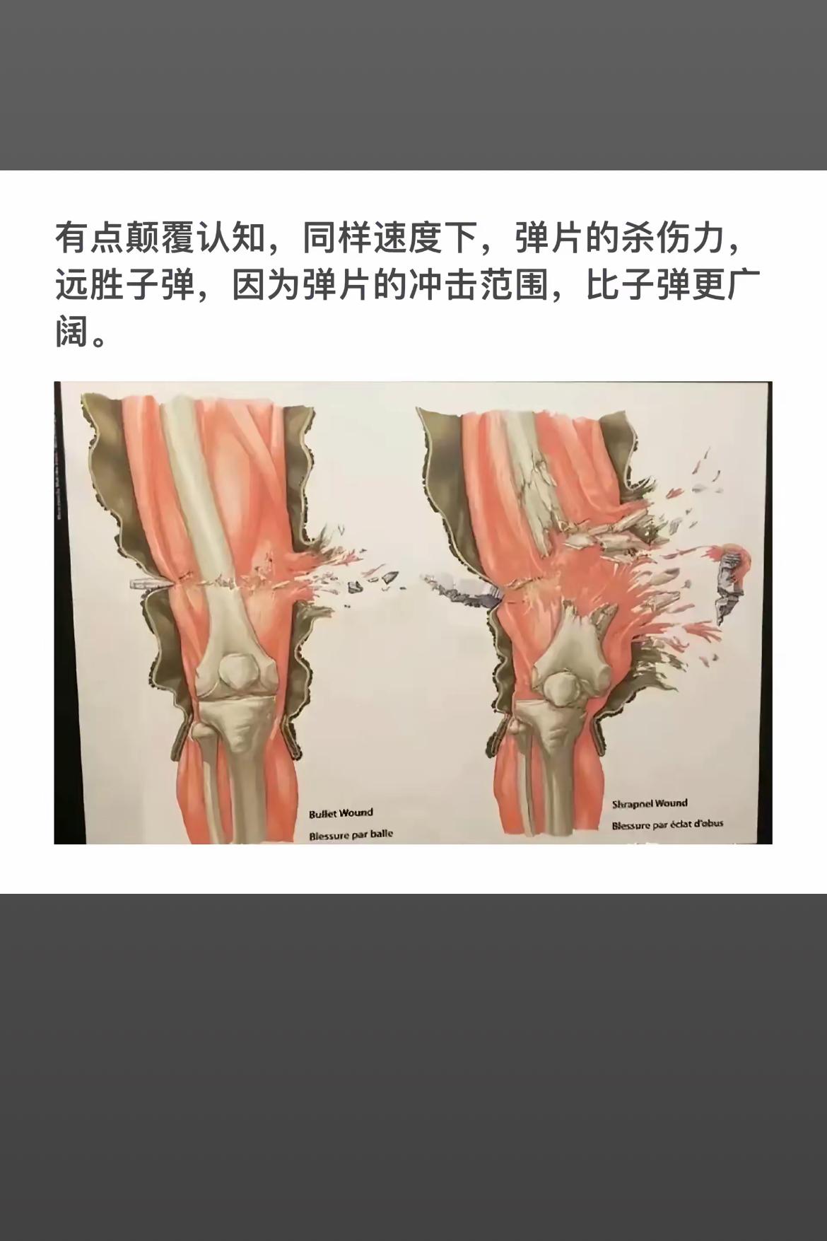 弹片与子弹的杀伤力对比：弹片更广泛，破坏力更大！