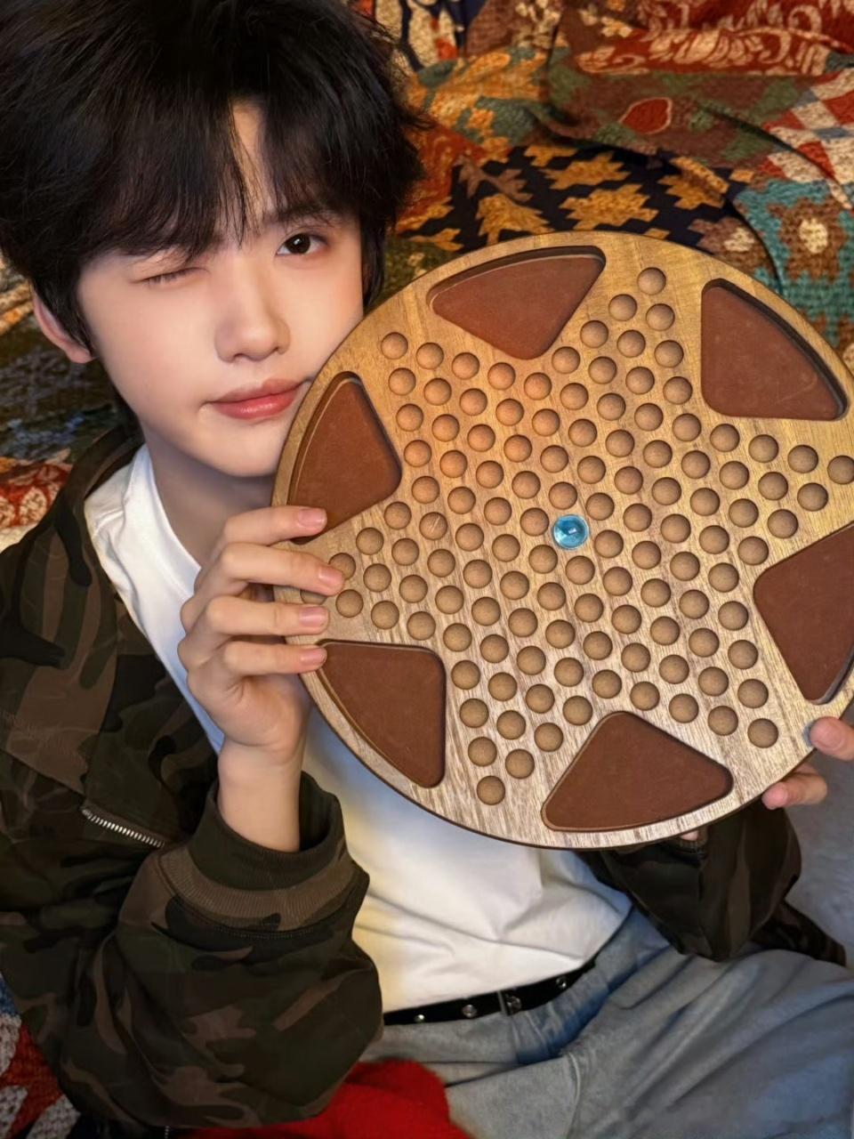 娱乐张奕然眼睛肿到wink张奕然今天一直在wink张奕然今天一直在wink，猪！