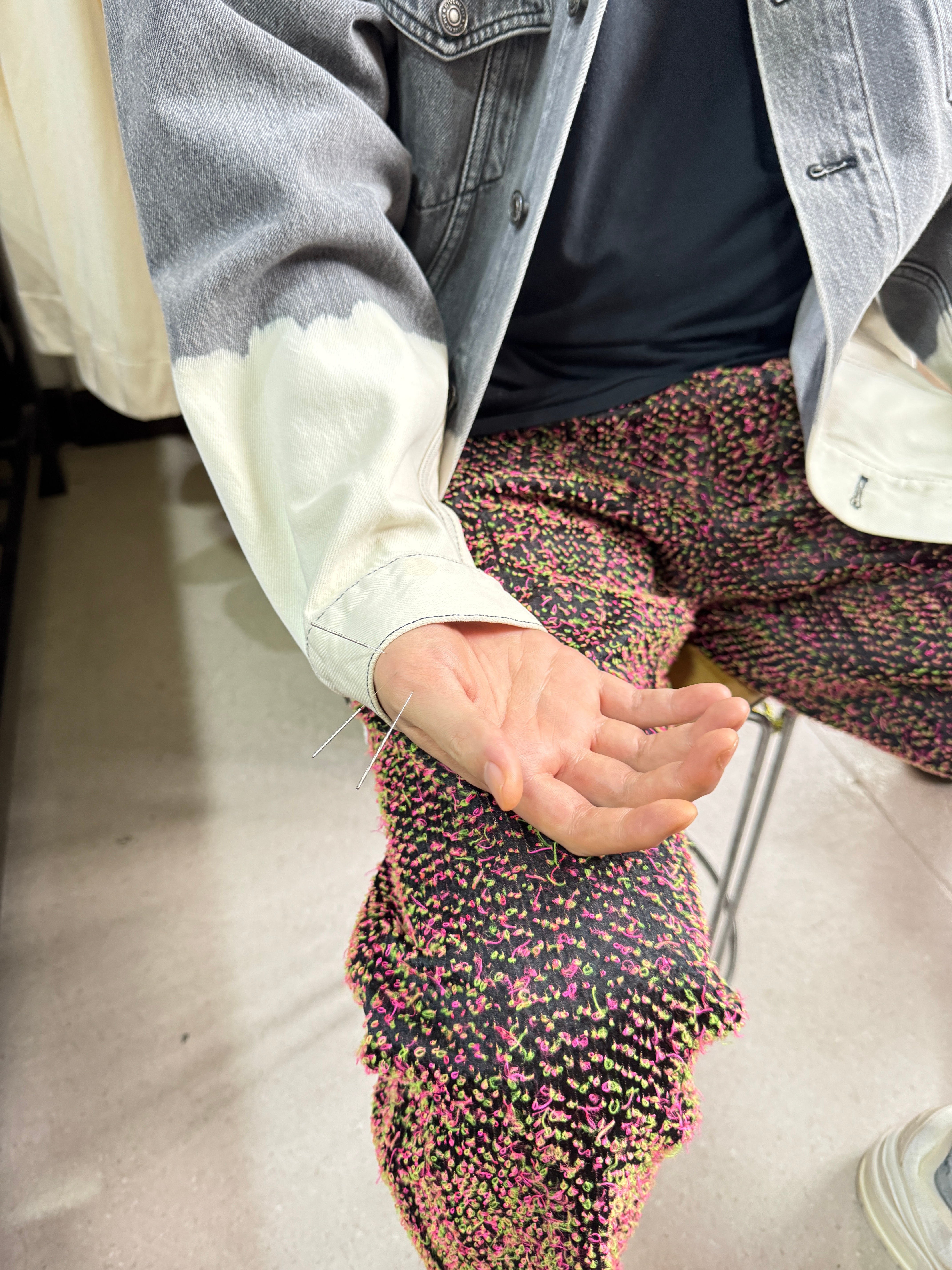 上次播完悟空，手有点不得劲，先以为没事，后来隐约疼到现在…今天终于去扎针了，直接