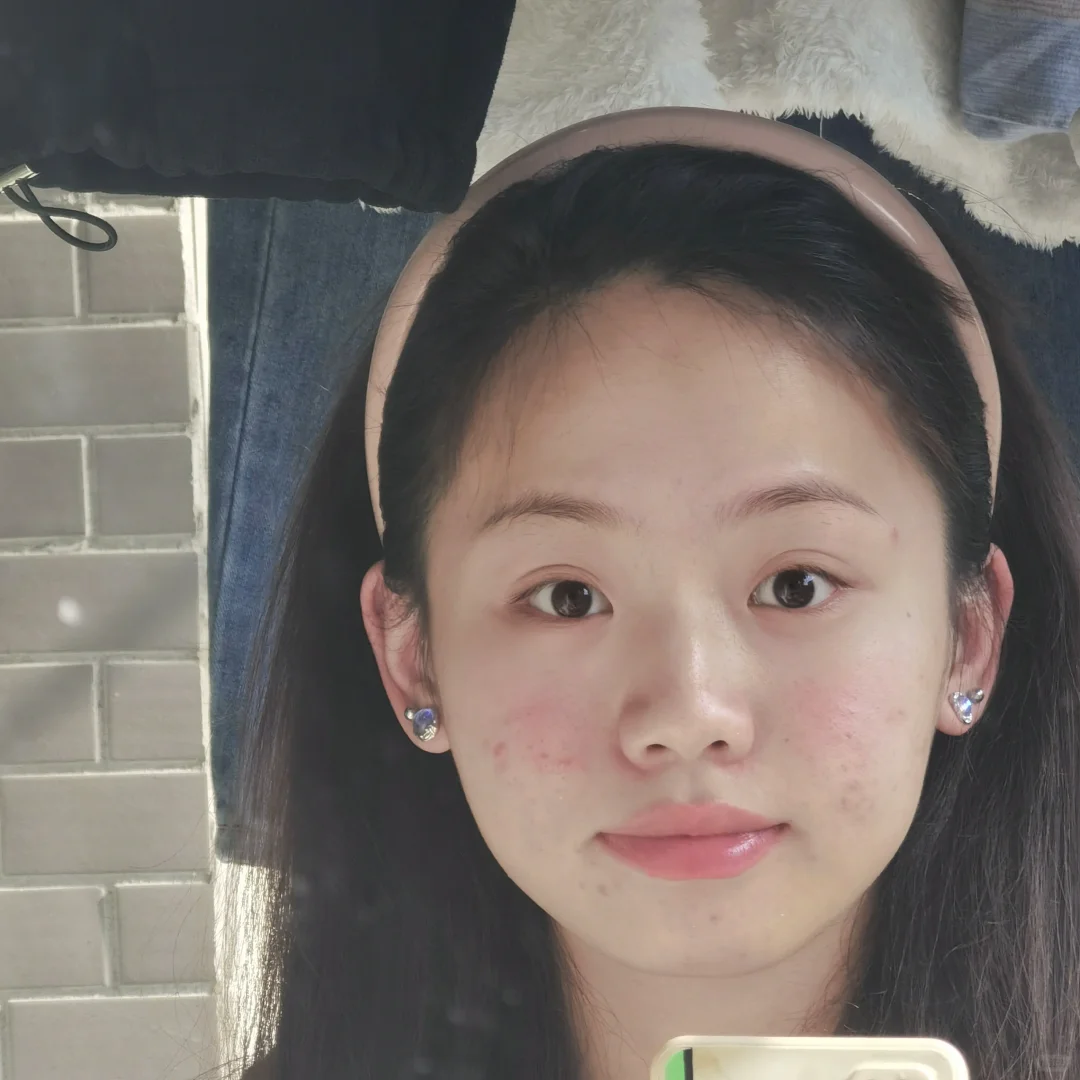 脸蛋破破烂烂