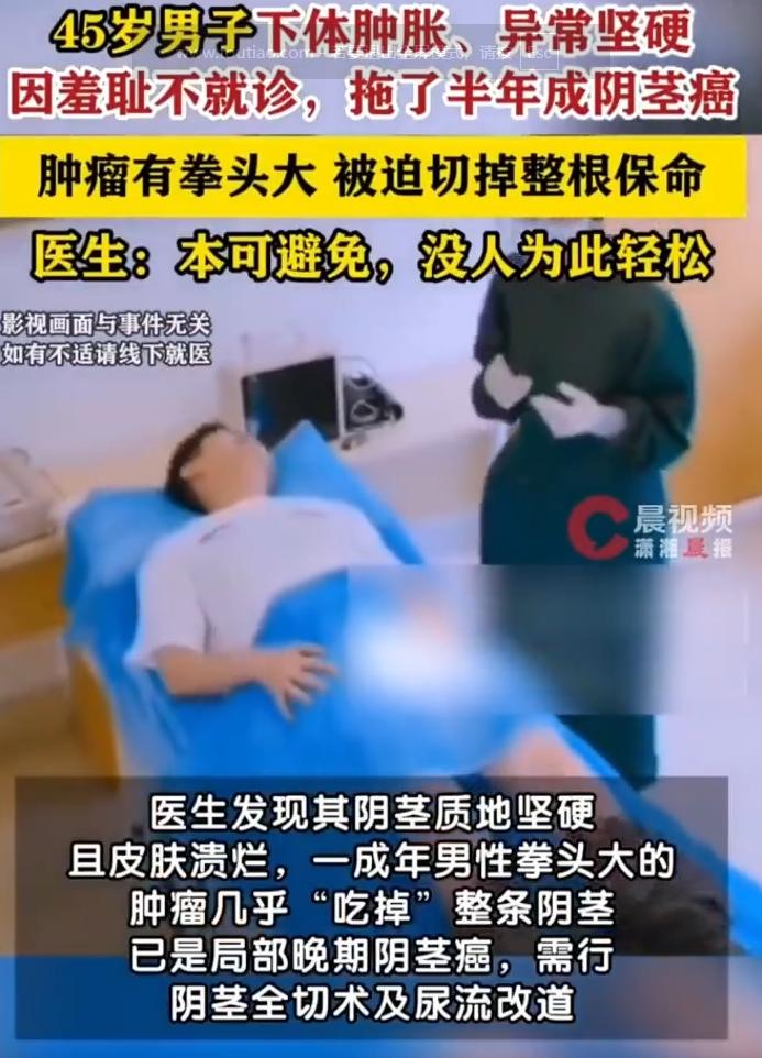 悲剧终究还是上演！8月27日哈尔滨日报报道，浙江杭州一名45岁男子，察觉下体又肿