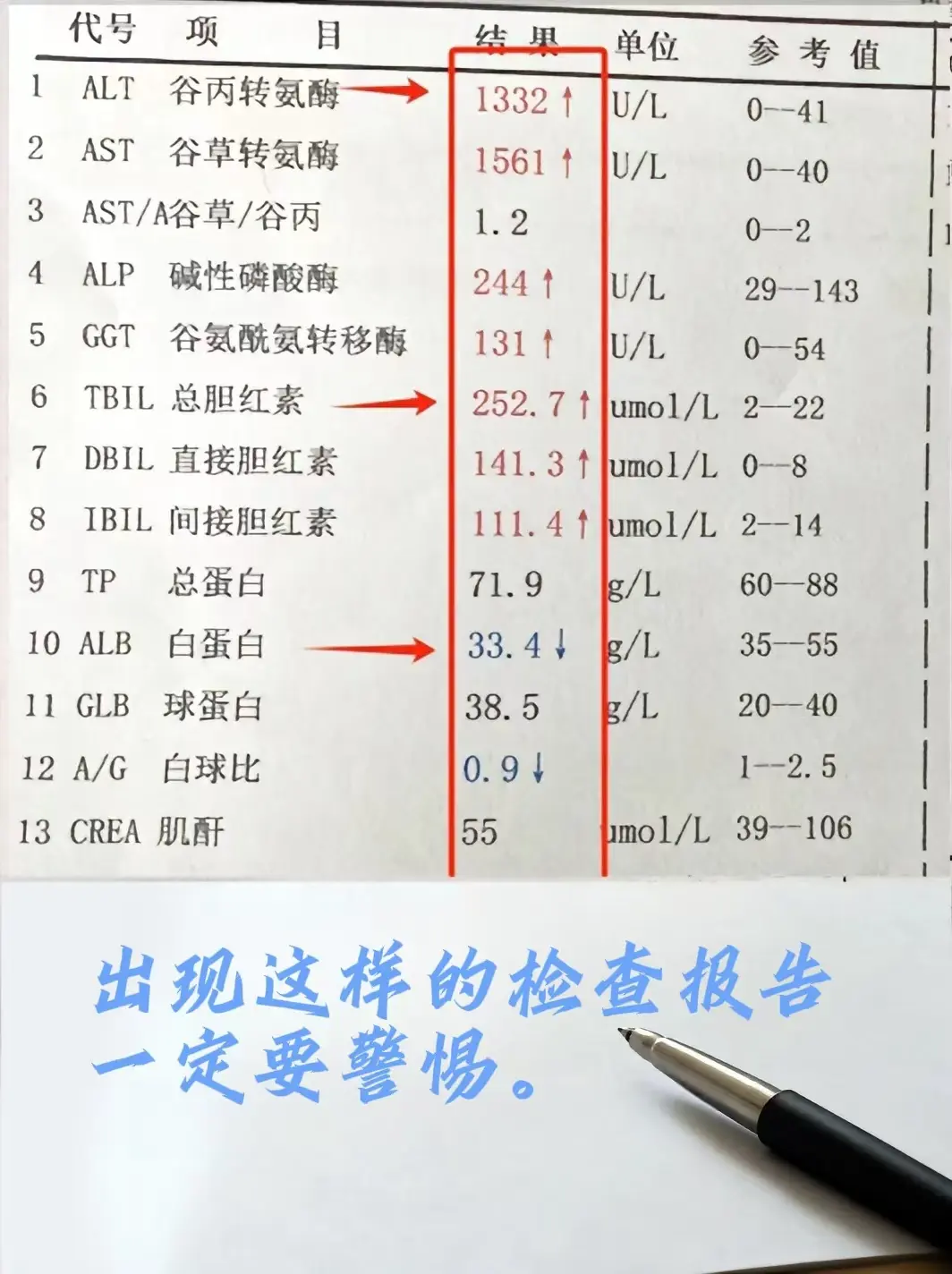 出现这样的检查报告一定要警惕！。这是一位淄博的肝病患者，肝功能检查时...