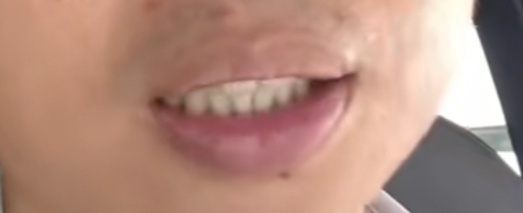 说话不讨喜，说话不利索，或者大嘴巴却不自知 