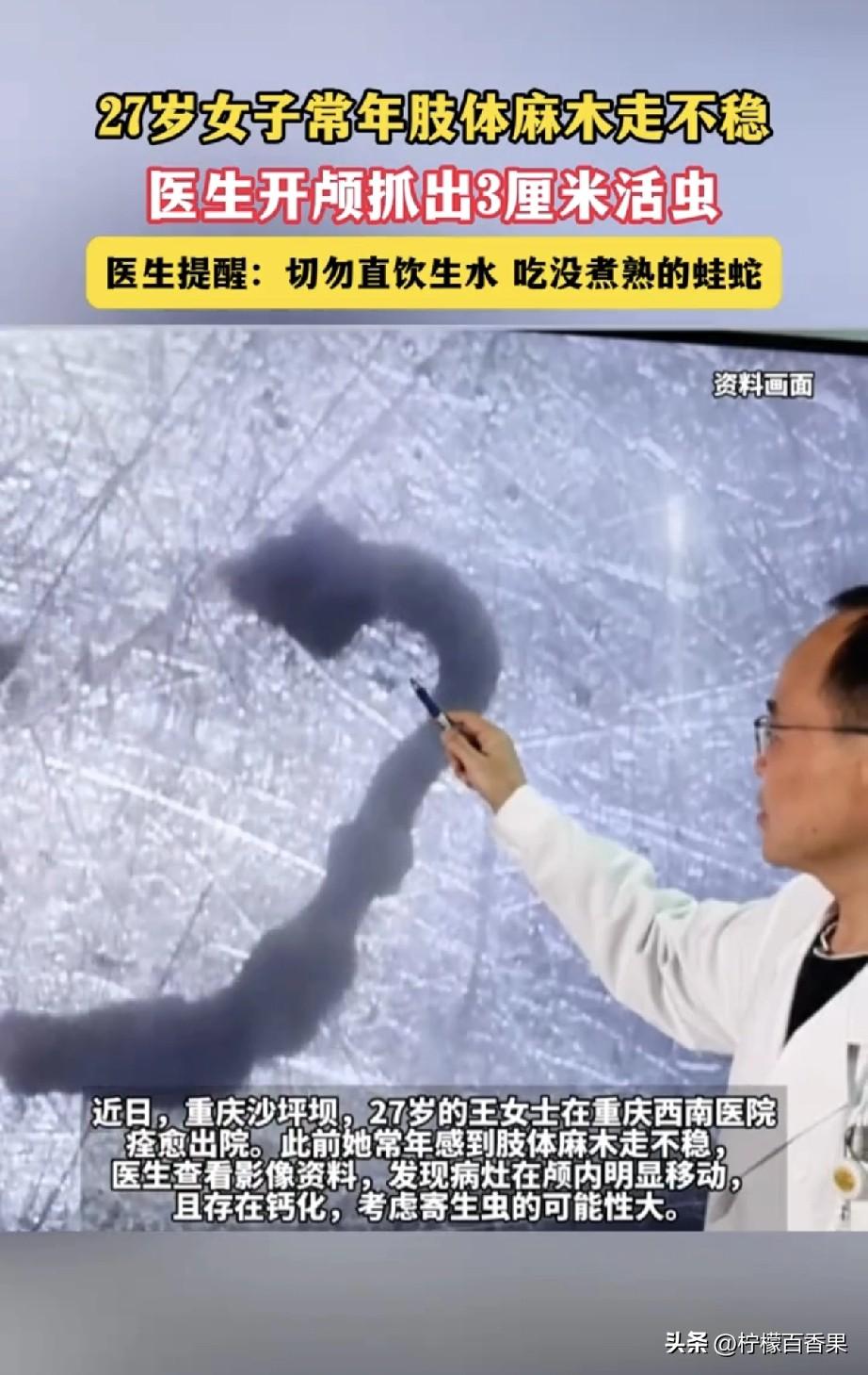 27岁姑娘脑中揪出3厘米活虫，罪魁祸首竟是我们常忽略的习惯
 
谁能想到，困扰一
