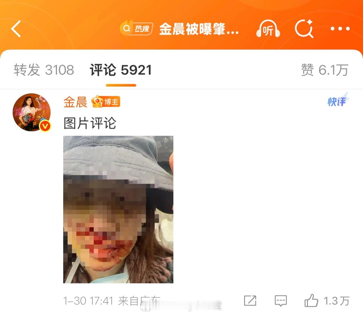 金晨发文道歉，并晒了自己当时受伤的照片：金晨道歉