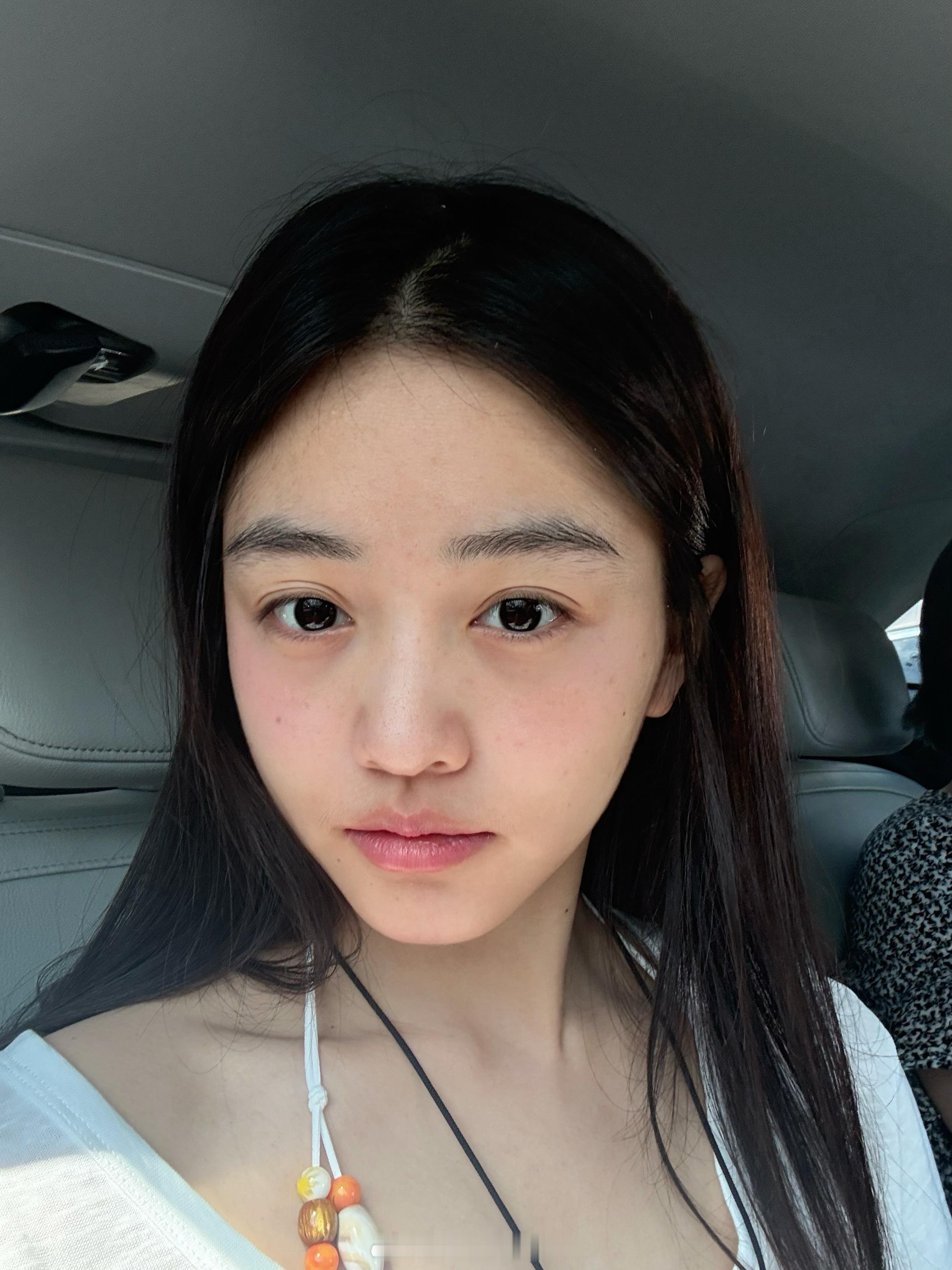 我一直没太相信面部针灸这个东西，直到我昨天试了一次，今天睡醒还肿着 状态已经巨好