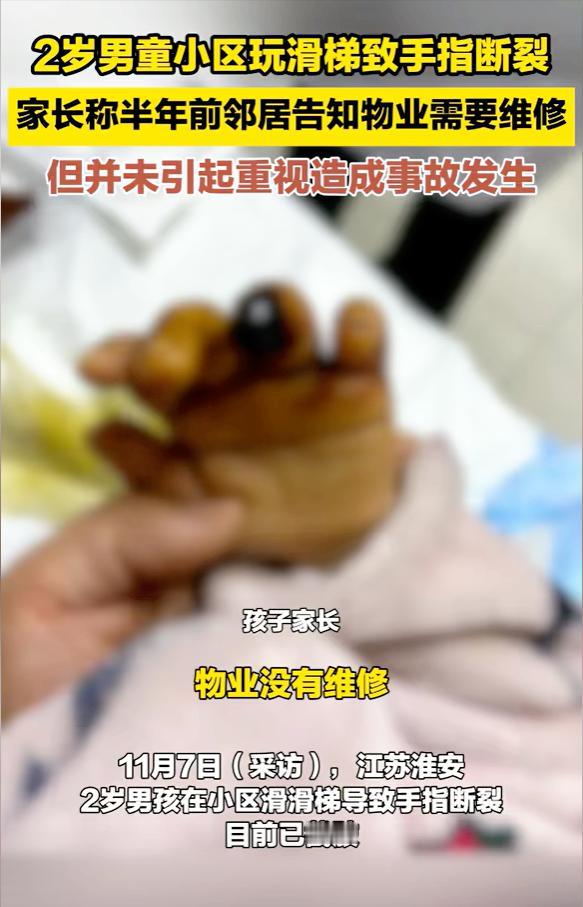 江苏淮安，2岁男孩在小区玩滑梯，手指不小心被滑梯割断，当场大哭，送医后被截肢，家