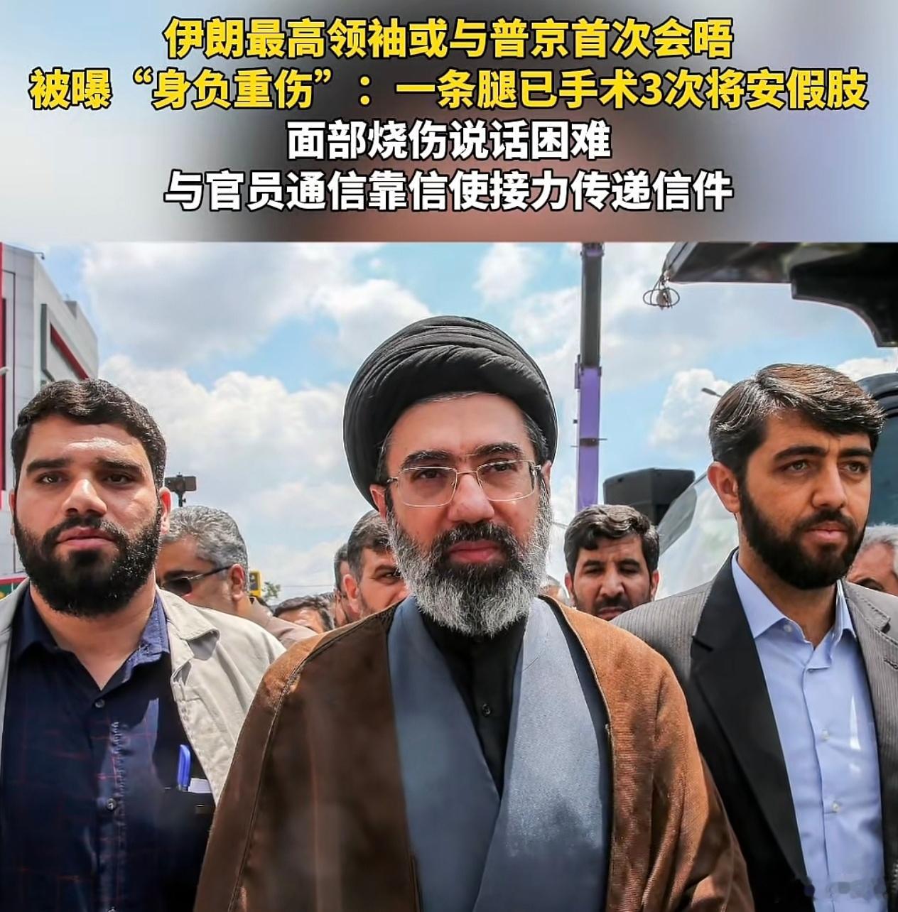 腿也瘸了，容也毁了，这还咋出来公开讲话？ 