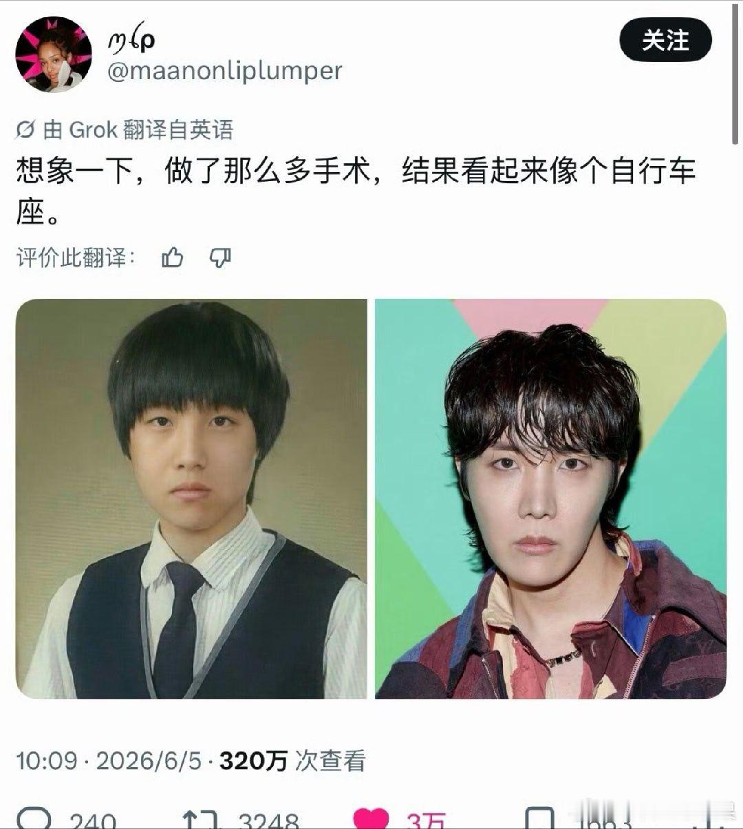 我的法。。。外网网友怒评 BTS 郑号锡长相：想象一下，做了那么多手术，结果看起