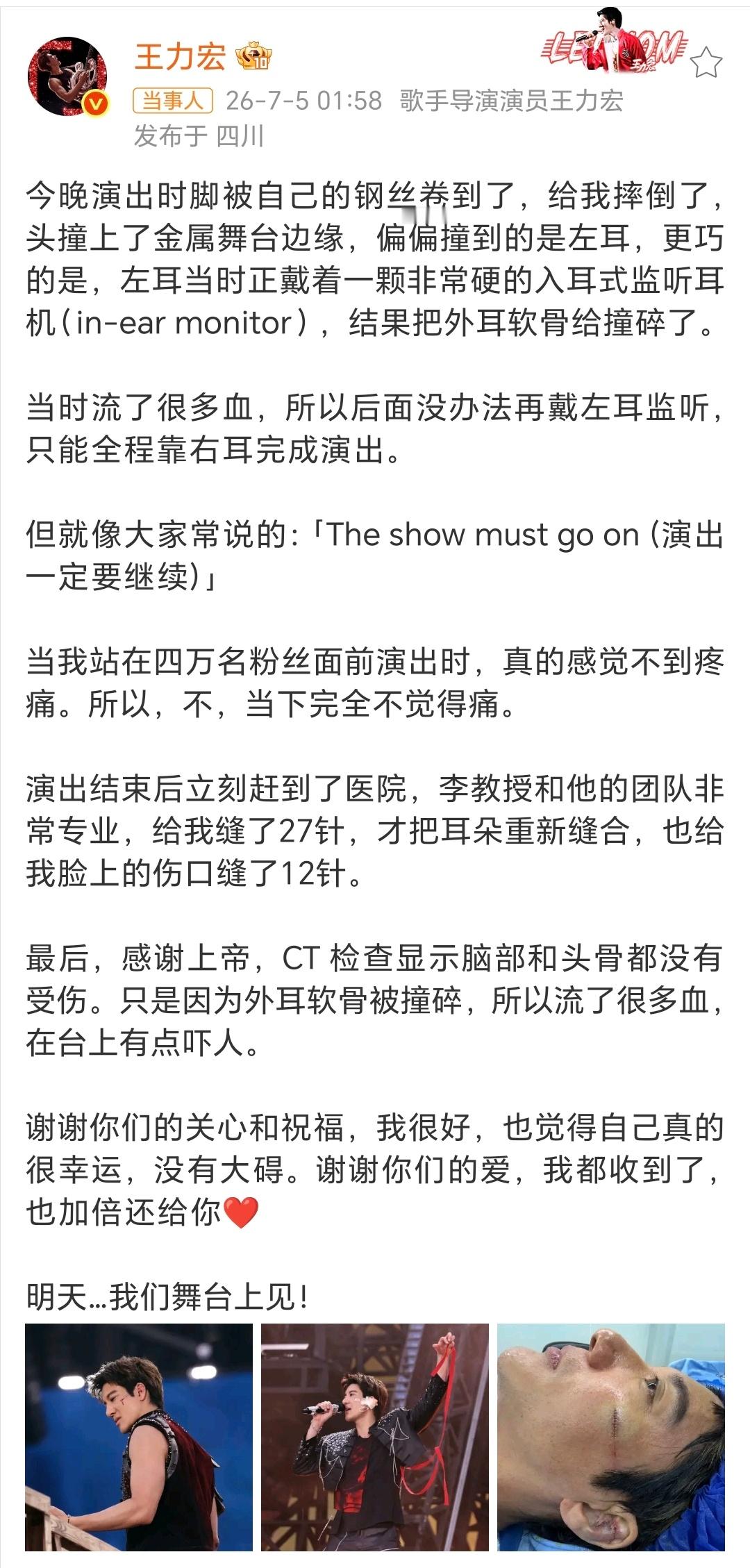 老一辈艺人是这样子的，无论做任何事都特别的拼，所谓的“轻伤不下火线”指的就是他们