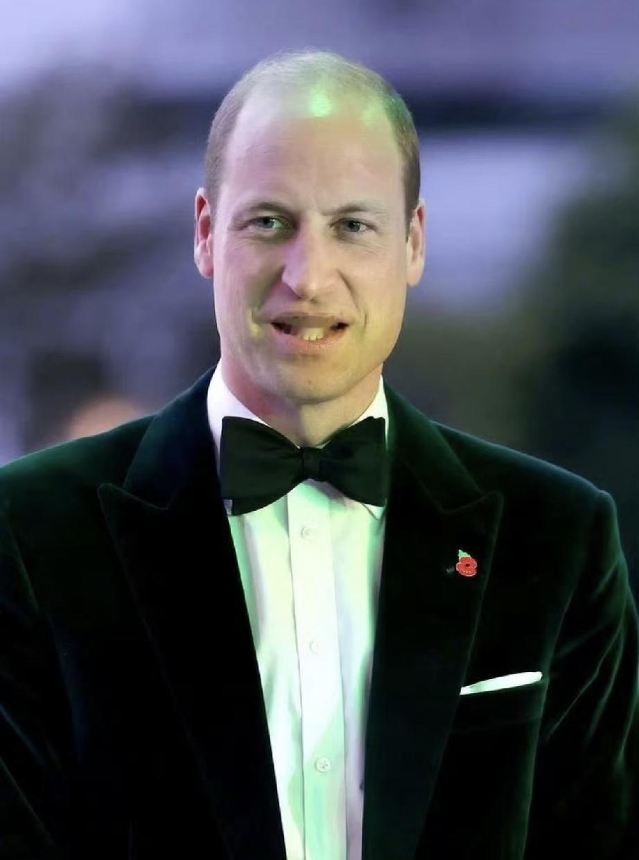威廉王子曾当选全球第一光头男。
很奇怪，那么注重王室形象的伊丽莎白女王，为什么不