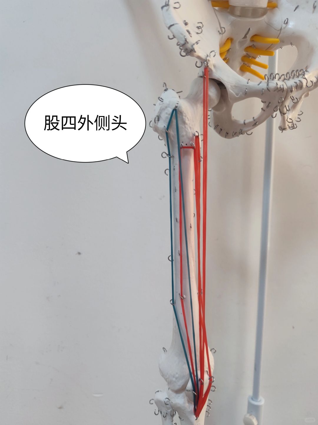 股四头肌——股外侧肌