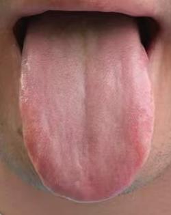 肾精亏空宗筋失养，只进补不填精难稳住状态






一些男士朋友年纪不算太大就