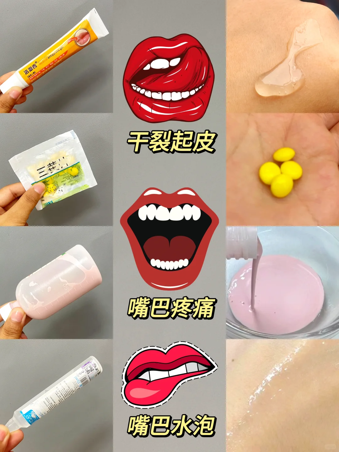 Vocal！唇炎就这么上岸了！！