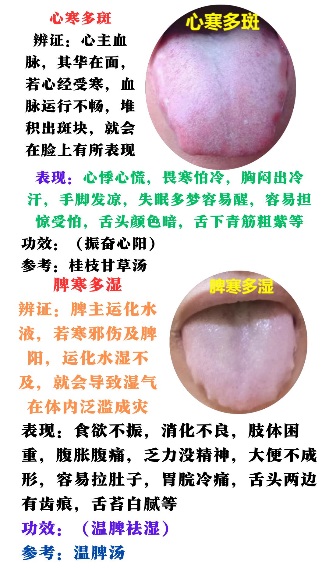 心寒--多斑、肾寒--多尿、脾寒—多湿、肺寒—多涕、肝寒—多痛，今天给你讲清楚，