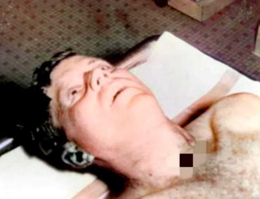 1963年，约翰·肯尼迪遇刺身亡后，一张罕见的遗容照片清晰记录了他生命最后的瞬间