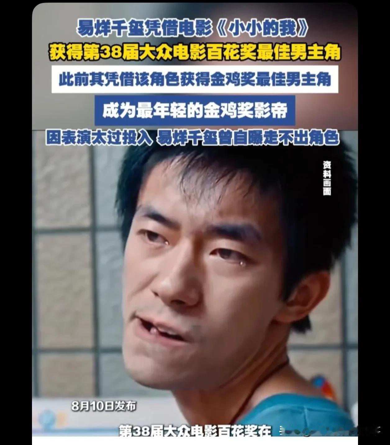 哇！一个正常人装成脑瘫儿的样子，他装的好成功好像，他这样年轻还能做到这样的演技，