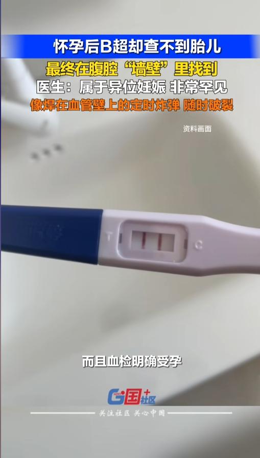5月7日报道，深圳一名女子自测验孕棒查出怀孕，随即前往医院做进一步检查，血检结果