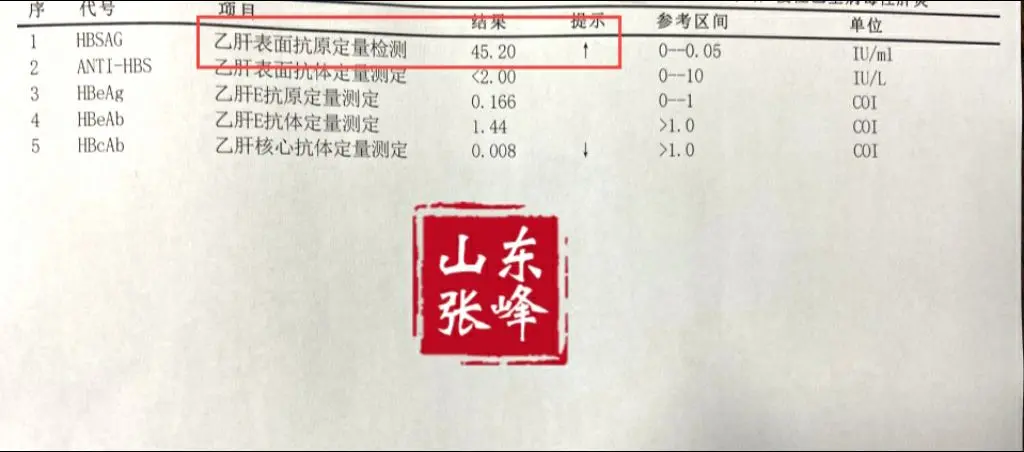 乙肝表面抗原小于50，有转阴可能吗？这个水平的表面抗原算是一个比较低的...