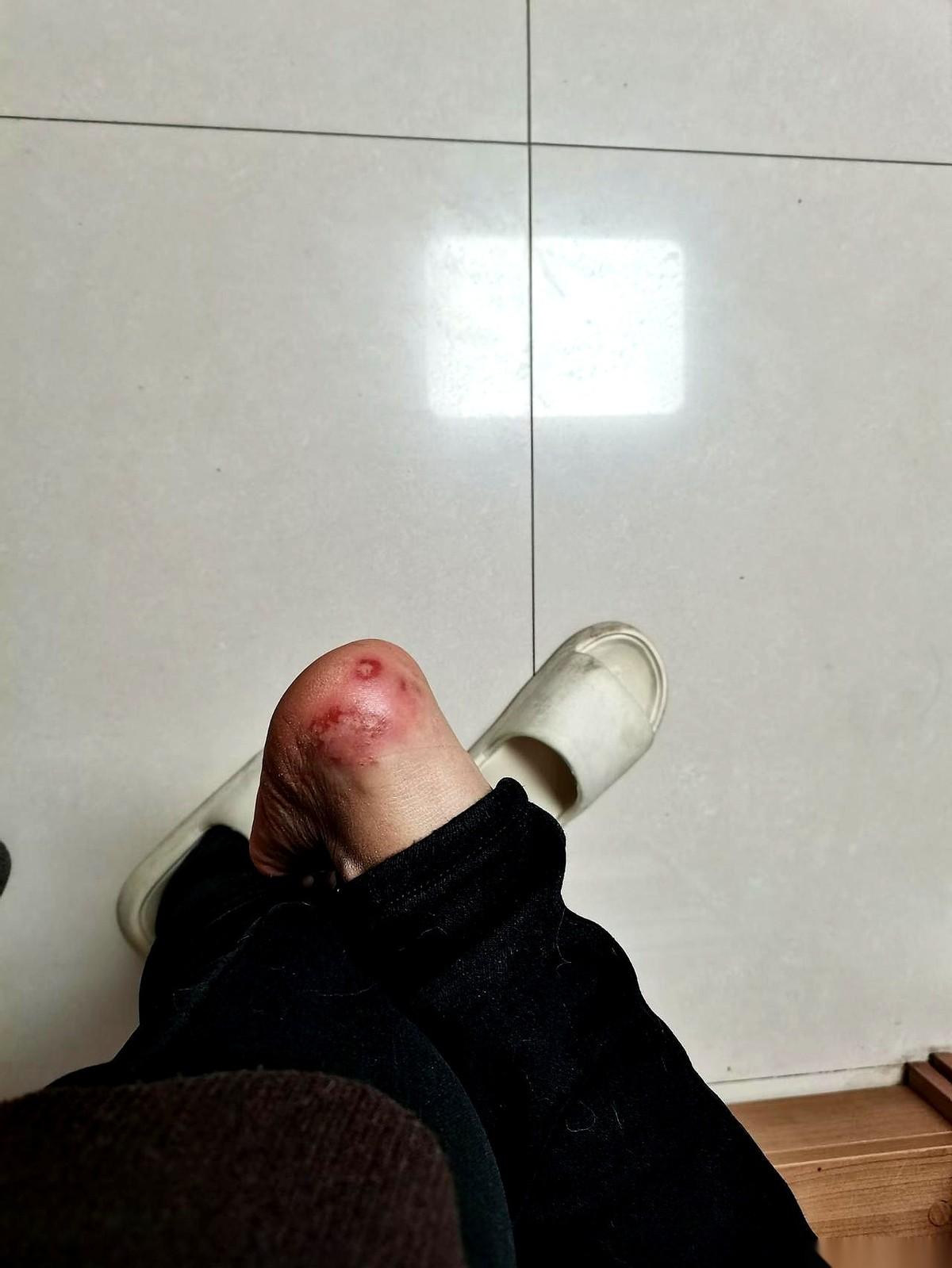 亲戚在洗车店干活，昨天来我家，刚一进门，换鞋的动作就停住了。
她弯着腰，一只手扶