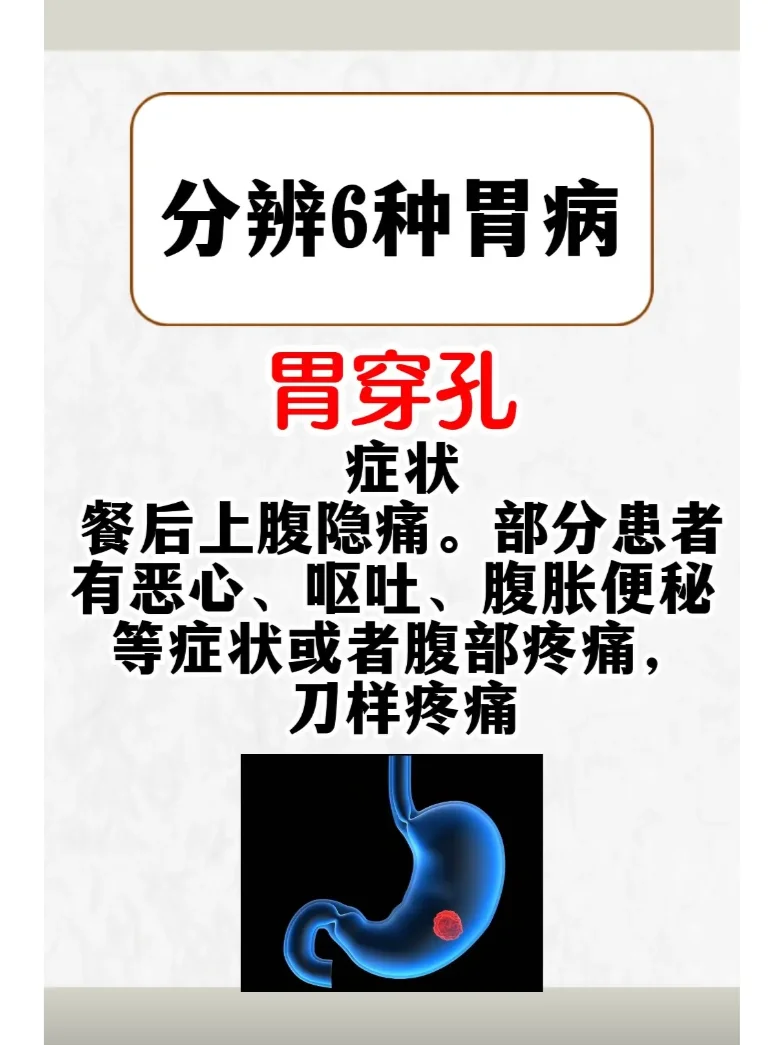 如何分辨6种常见胃病