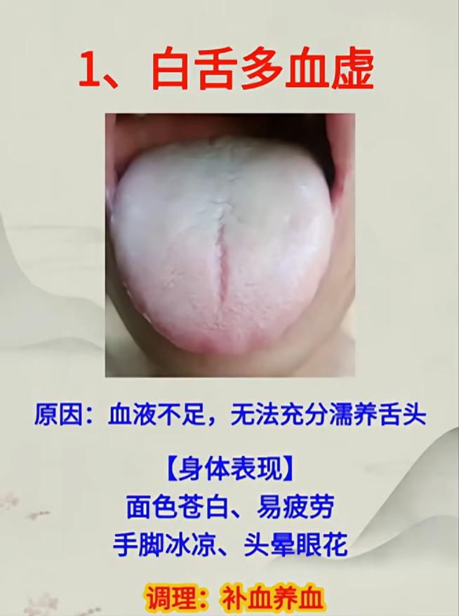 舌头发白、发紫、发红，分别代表什么问题？