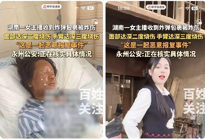 怎么会送快递装上炸y包给她
是刷了礼物她没兑现承诺
苍蝇不叮无缝的蛋，这辈子算是