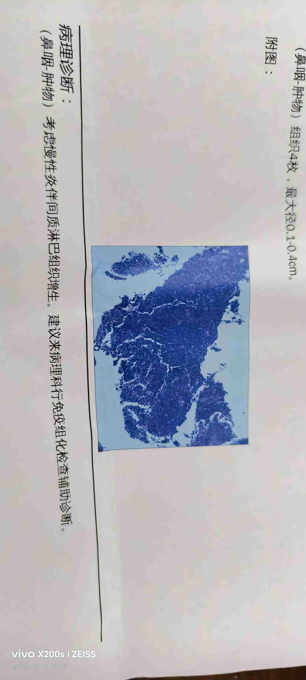 花了三千多，挂了150的号，医生对我说了三个字

这半个月，我经历了从“天塌了”