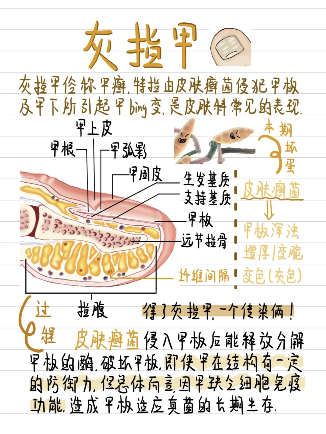 医学生笔记✍️-了解灰指甲