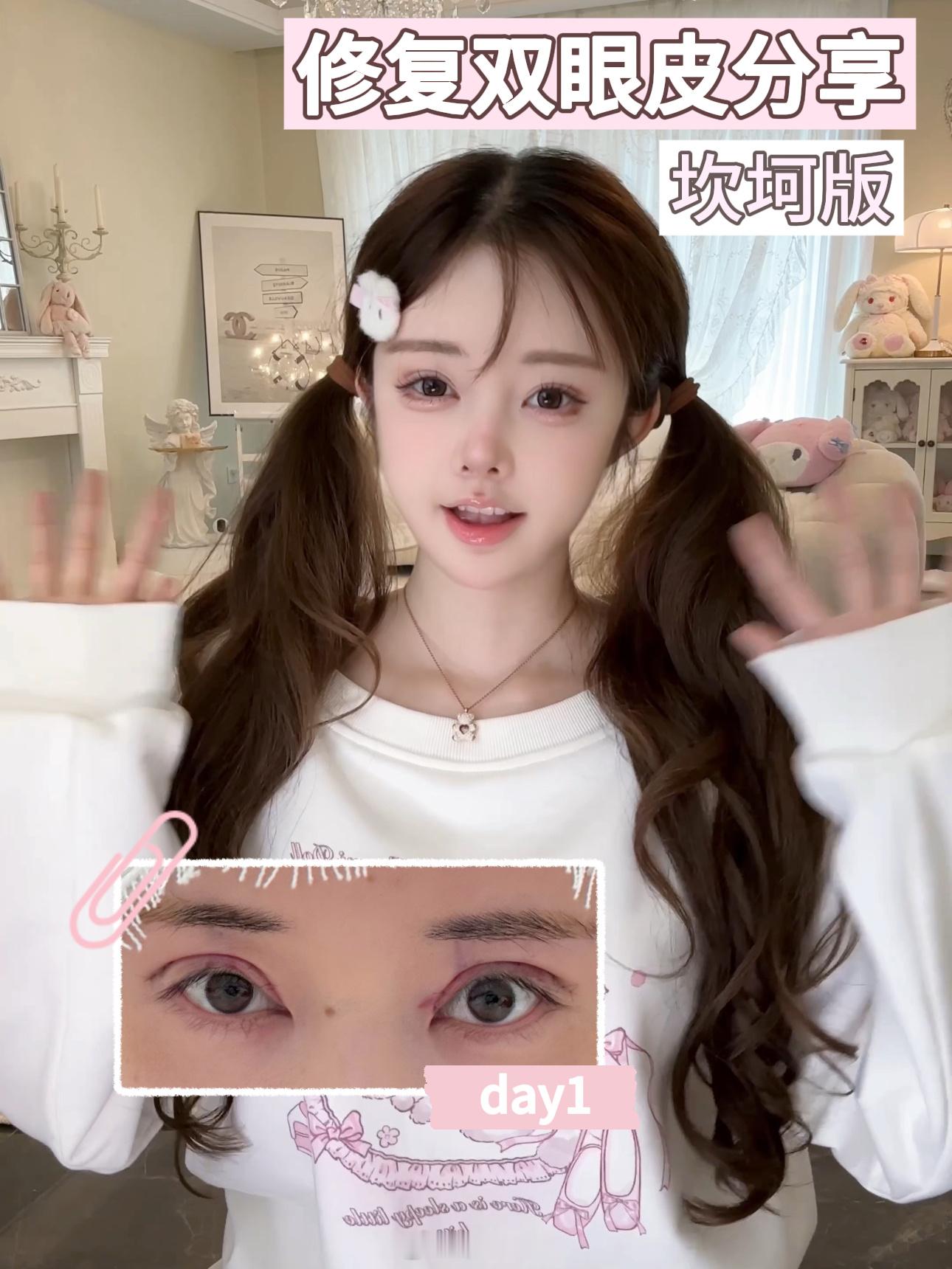 希望对大家有帮助！快去🍠看！ ​​​