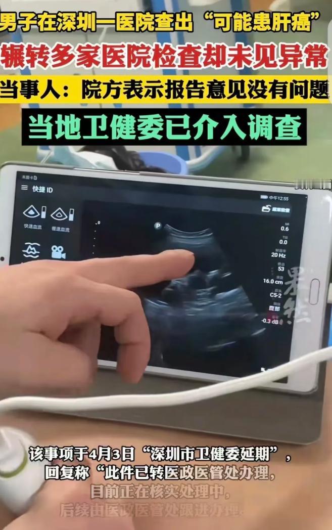 5月2日报道，深圳一名男子到医院做体检，被查出疑似患上肝癌。突如其来的疑似重病结