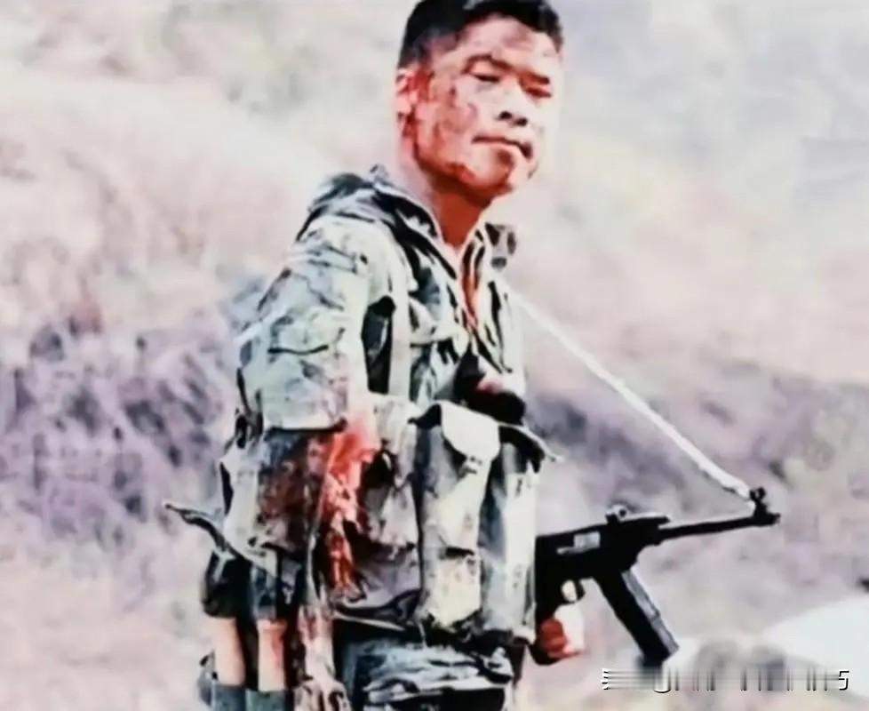 1984年老山战役，炮火中他的手臂被炸，极度痛苦中他用匕首切断伤臂，将其别在腰间
