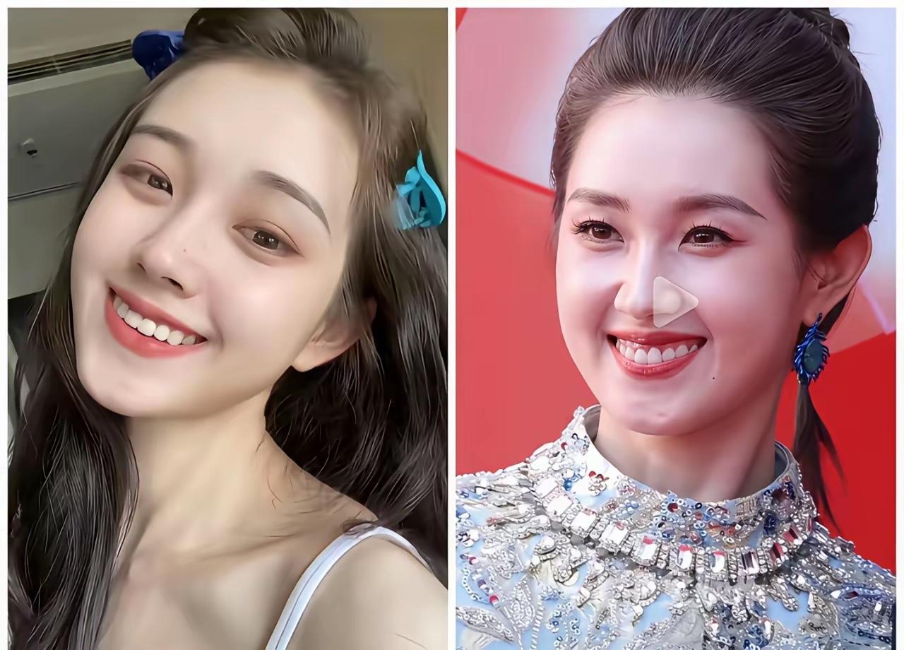 左边是郭宇欣23岁的时候
右边是郭宇欣26岁
发现了吗，郭宇欣23岁的时候，牙齿