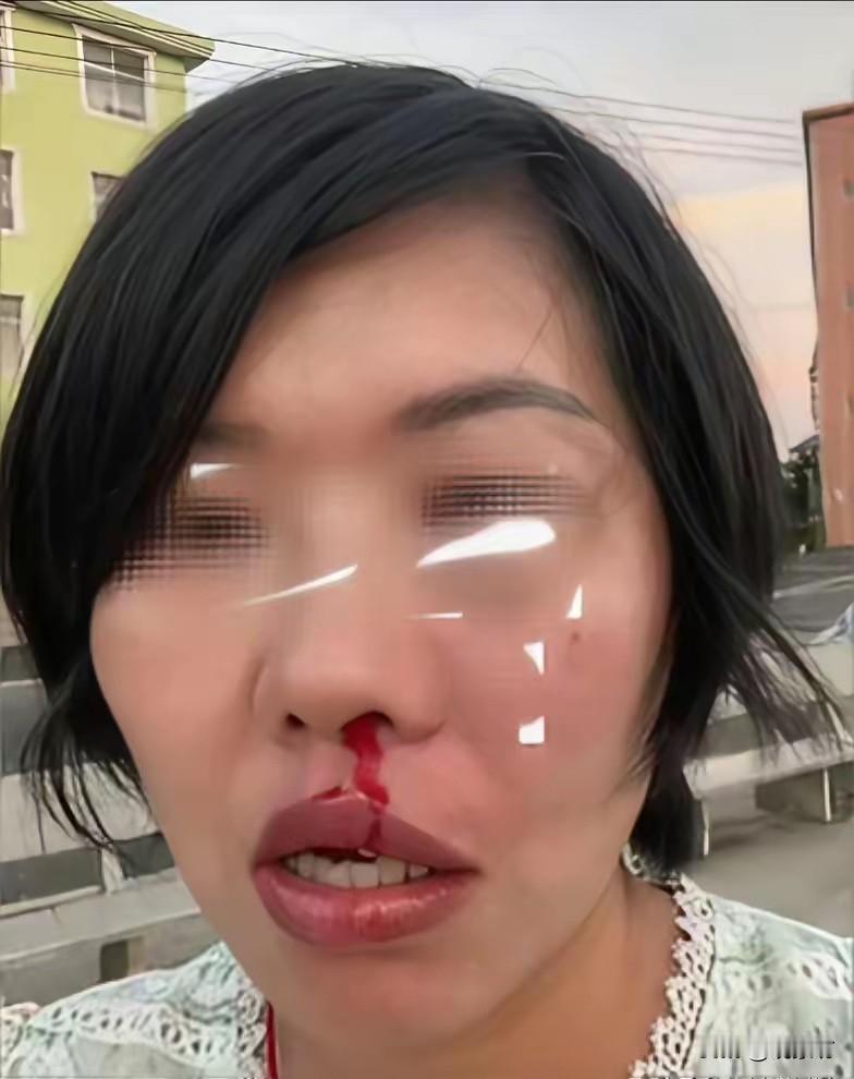 江西菜市场那出“买鱼拒付反被揍”的闹剧，看得人心里只有一句话：打得好，打得妙，打