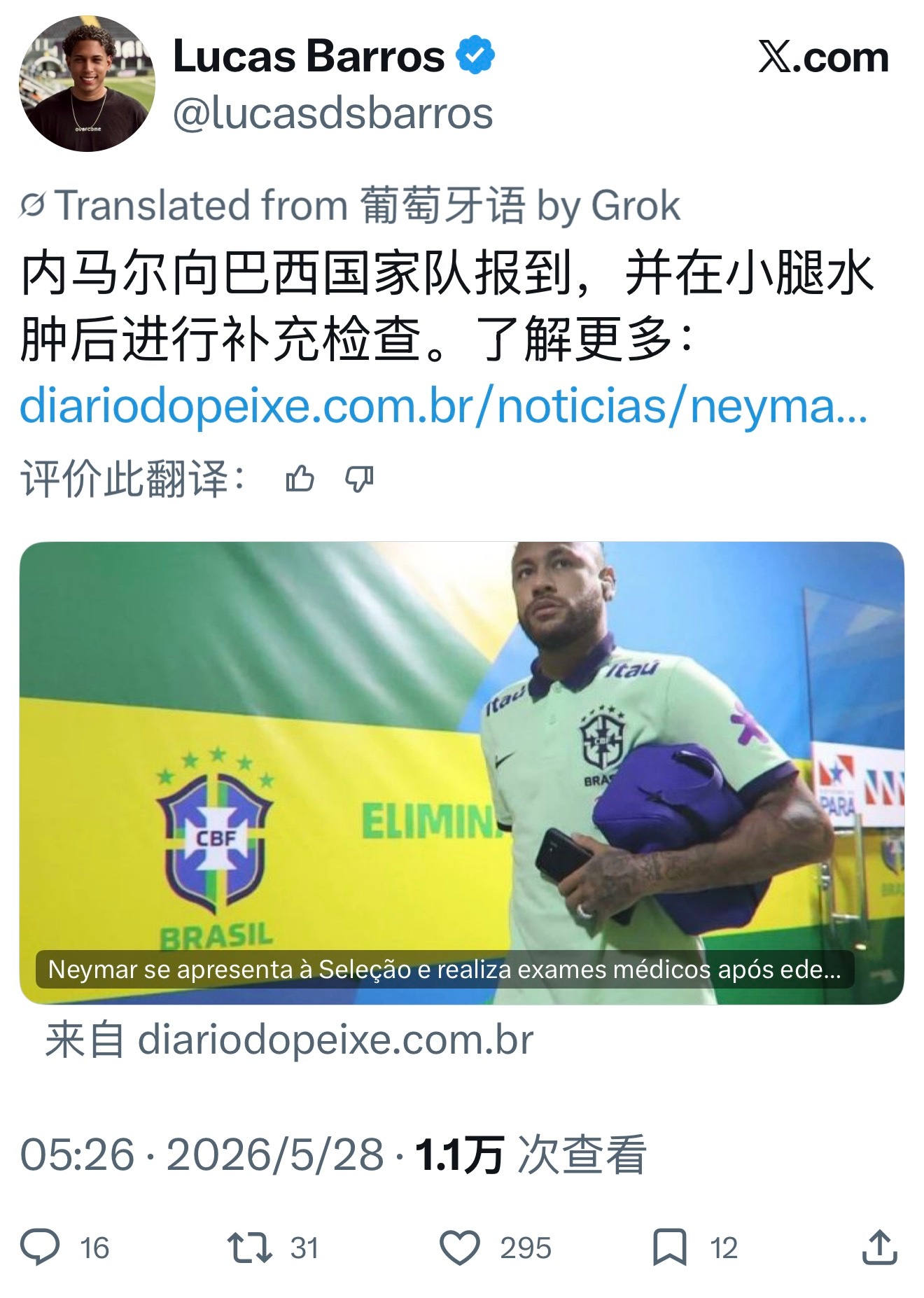 内马尔 DIÁRIO DO PEIXE「内马尔小腿水肿后向巴西队报到并接受医学检