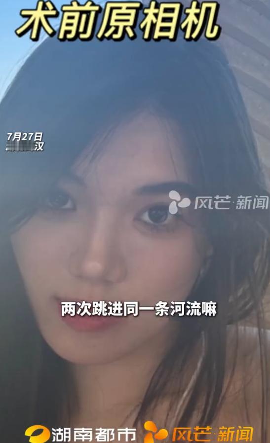 9月4日，曾因正颌手术失败引发全网关注的24岁女孩“小雨”在社交平台发布声明：所