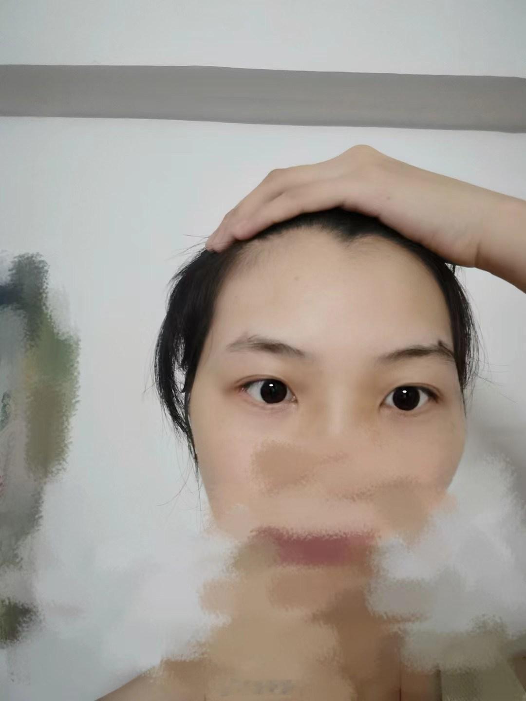 感谢铁粉支持。这面相有明显的美人尖，多数与父缘分浅或早出社会，感情上被动现桃花应