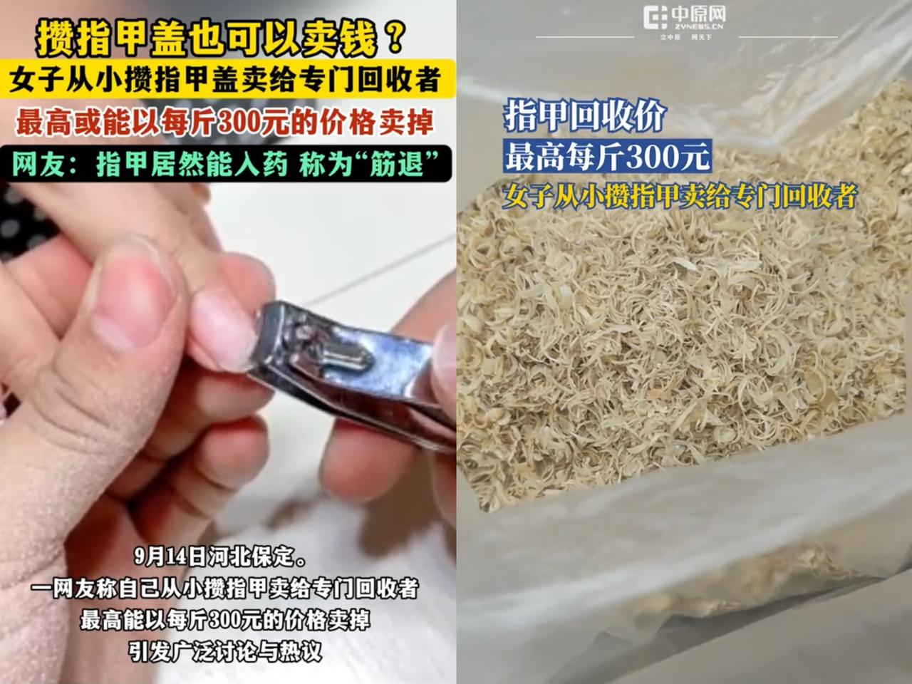 惊不惊喜？
意不意外？
竟然有人靠攒指甲盖赚钱！

河北一女子从小就攒指甲盖，然