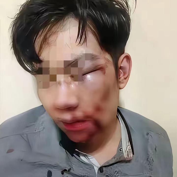 女子远嫁，老公觉得她娘家远经常家暴她。今年春节多年没有回过娘家的妻子想回娘家看看