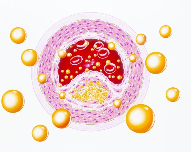 隔天吃一次他汀，降脂效果更好吗？医生忠告：服用他汀，牢记4点

对于高胆固醇患者