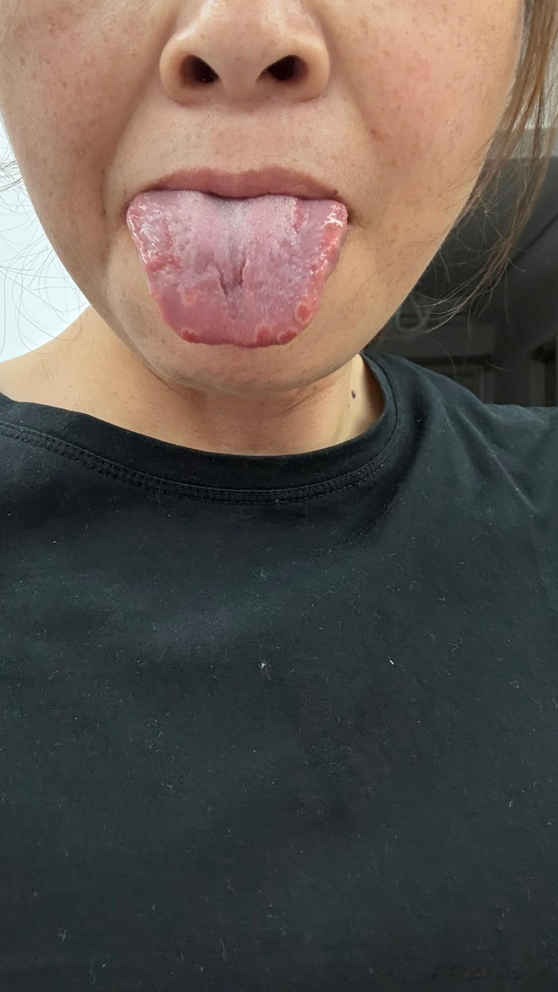 今天有点难过💔视频也没更新，直播一个小时都坚持不下来，我的舌头下午的时候就这样