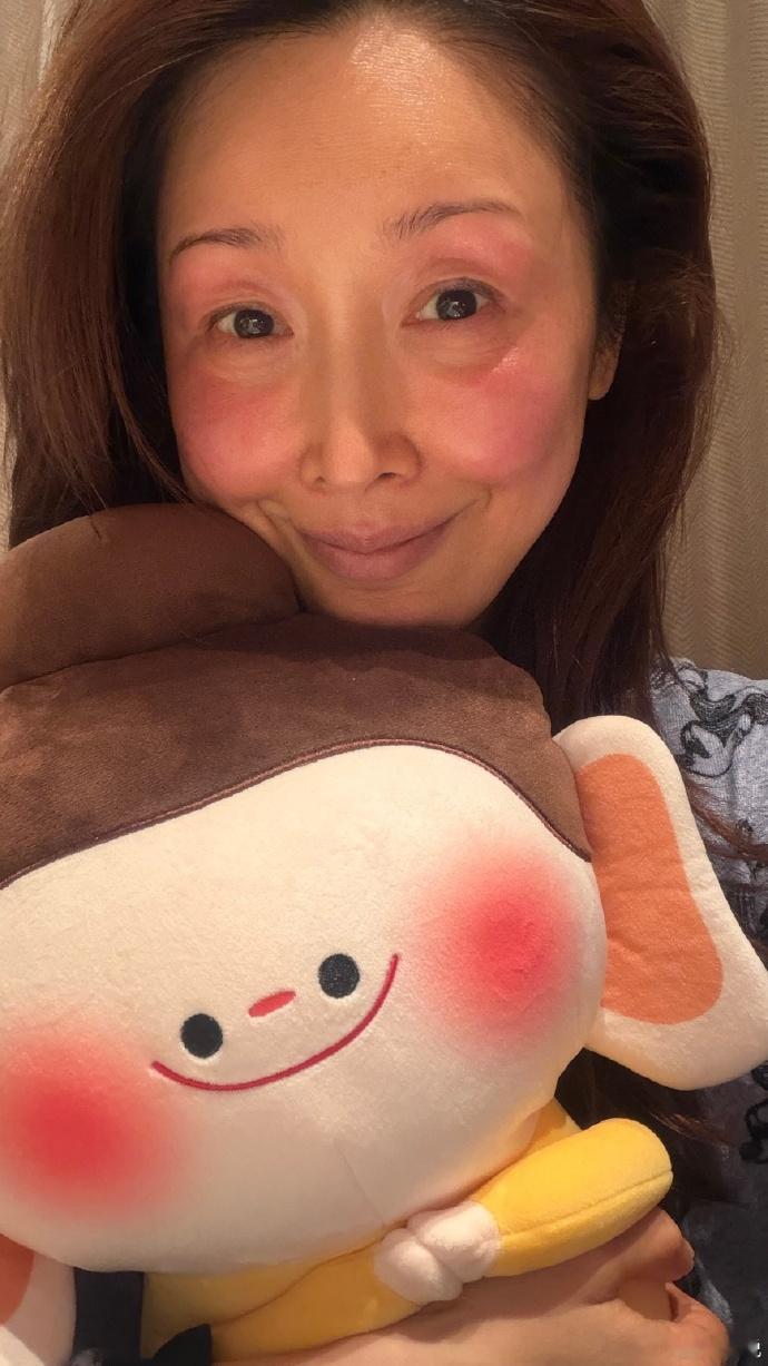 孙悦冻伤成佛小伴看到孙悦冻伤的脸庞，才知道春晚舞台的精彩背后，藏着这么多不为人知