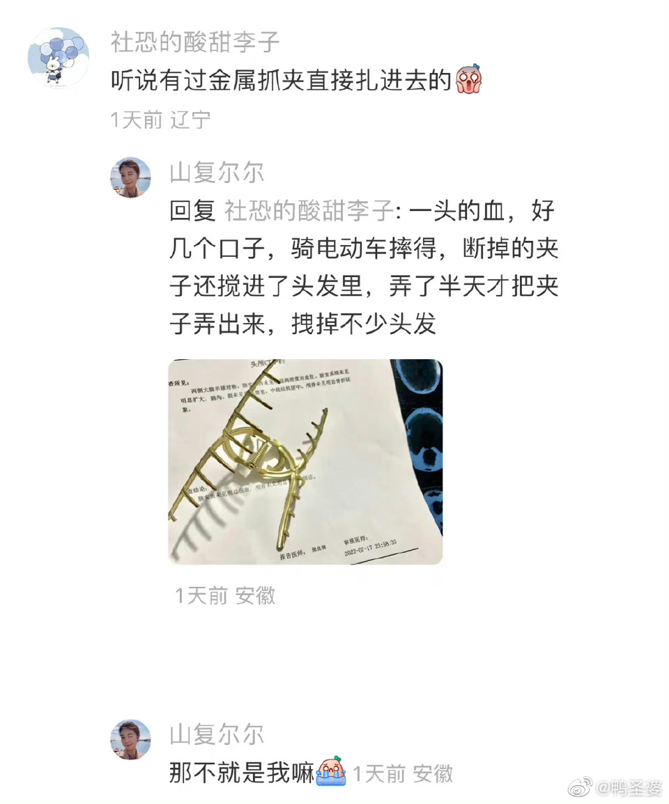 📬🧾:抓夹虽好看，但开车请别戴开车的姐妹看过来!真实发生的事件，因为觉得抓夹