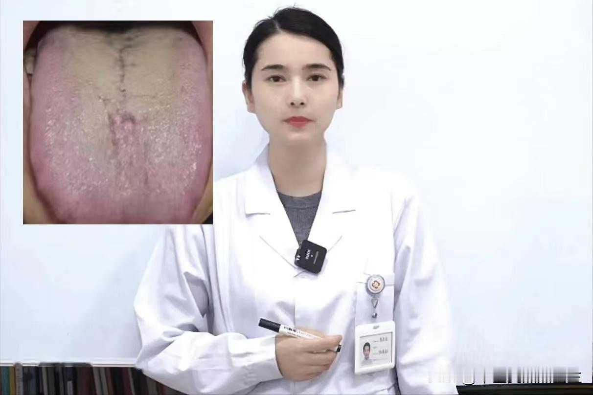 舌头长成这样，怎样补都无效，反而还越来越快，身体越来越虚，问题在哪？

患者主诉
