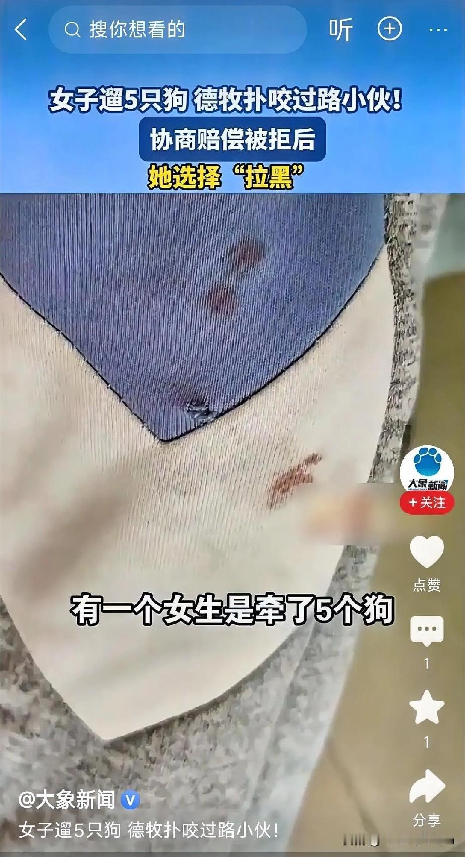 深圳一女子遛五条狗。其中一条大型犬咬伤路人想用1000元打发？不知道这脑洞是不是