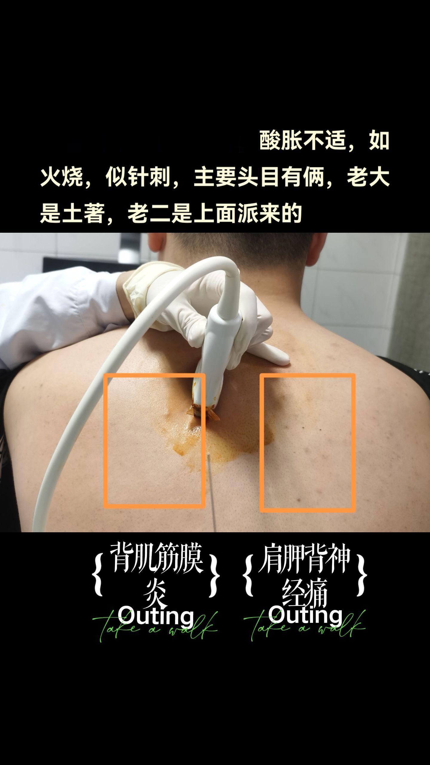两者作案手法各有不同，单独或共同扰乱片区安宁，抓捕归案需多种手段，尤其...