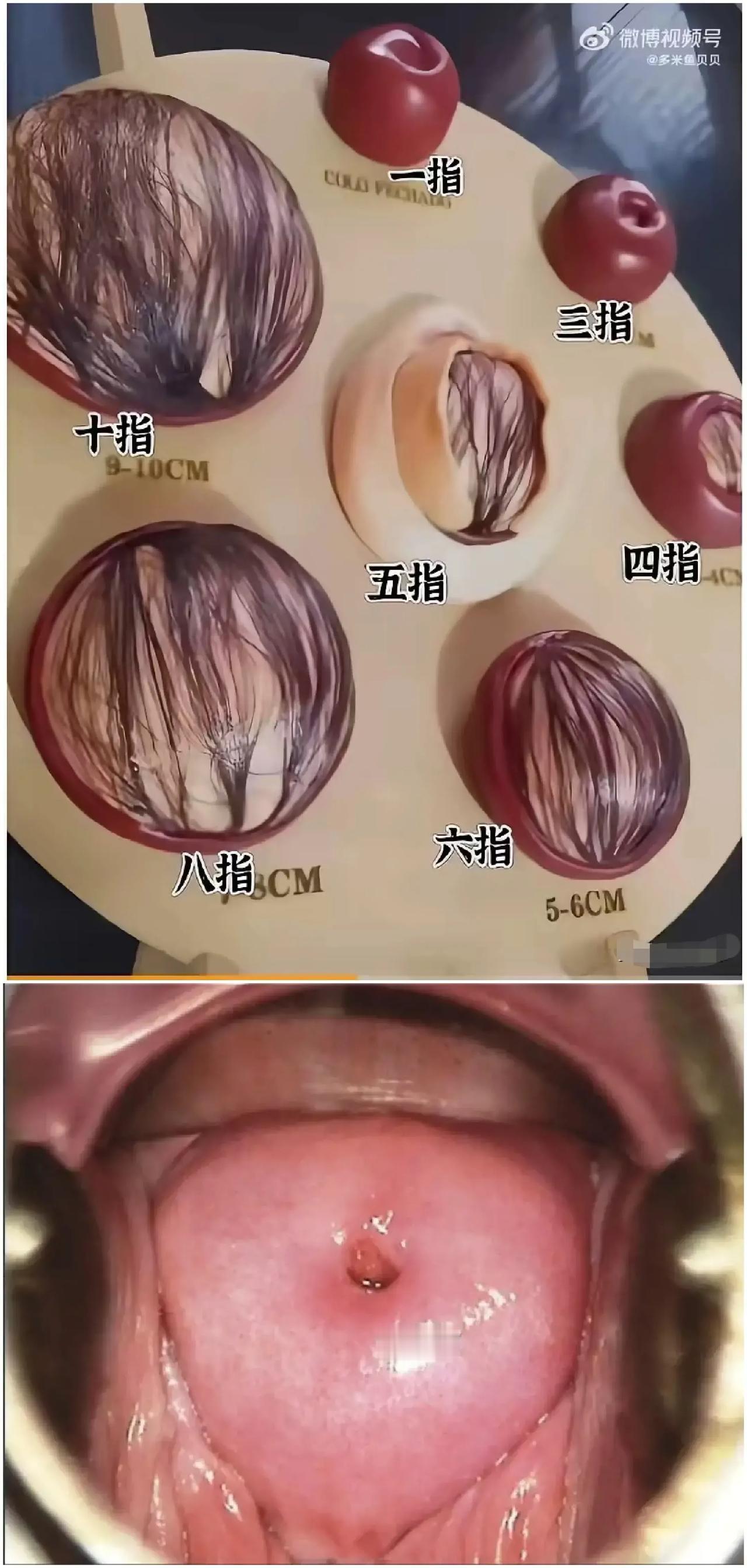 宫开十指！[发怒]
老百姓俗称，“开骨缝”！

在顺产前，去医院检查，医生经常会